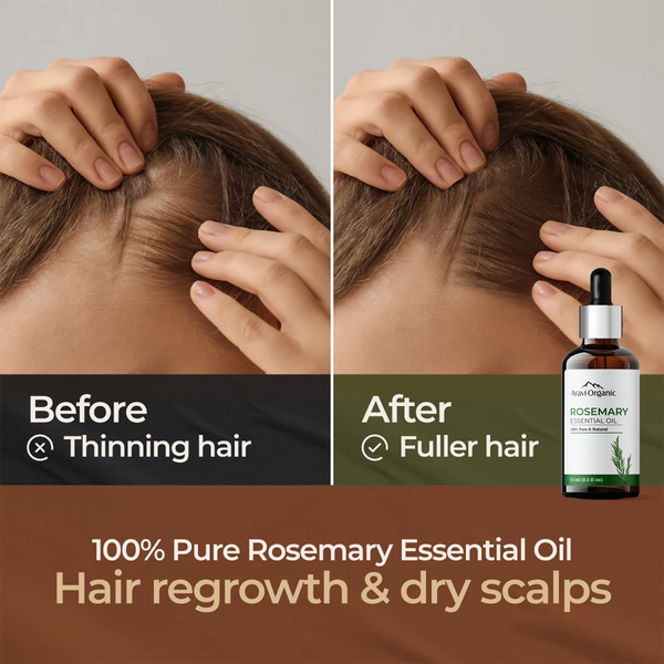 Rosemary Essential Oil | Promote Hair Growth |  100 ml