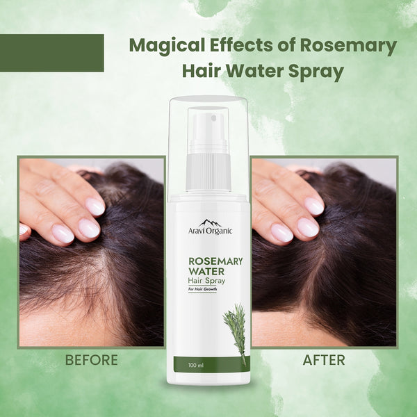 Rosemary Water Hair Spray | Hair Growth | 100 ml.