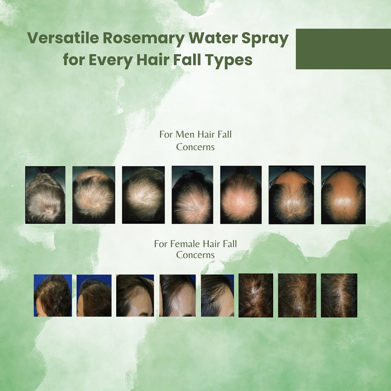 Rosemary Water Hair Spray | Hair Growth | 100 ml.